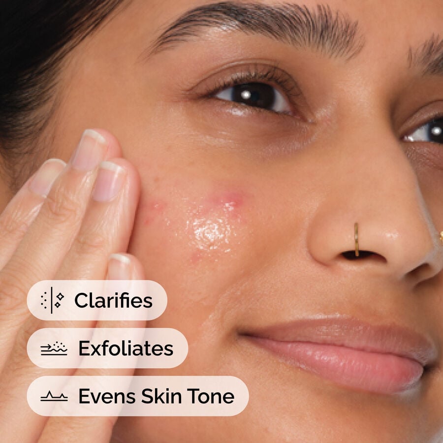 Gentle Salicylic Acid 2% Anhydrous Solution