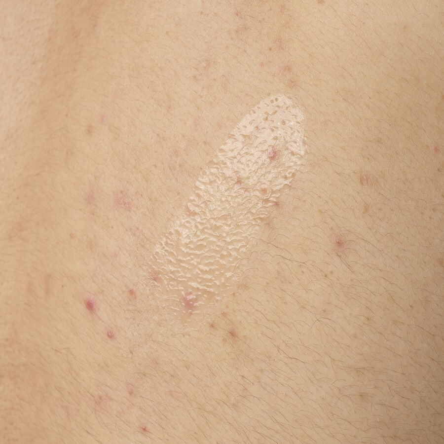 Salicylic Acid 0.5% Exfoliating Body Serum