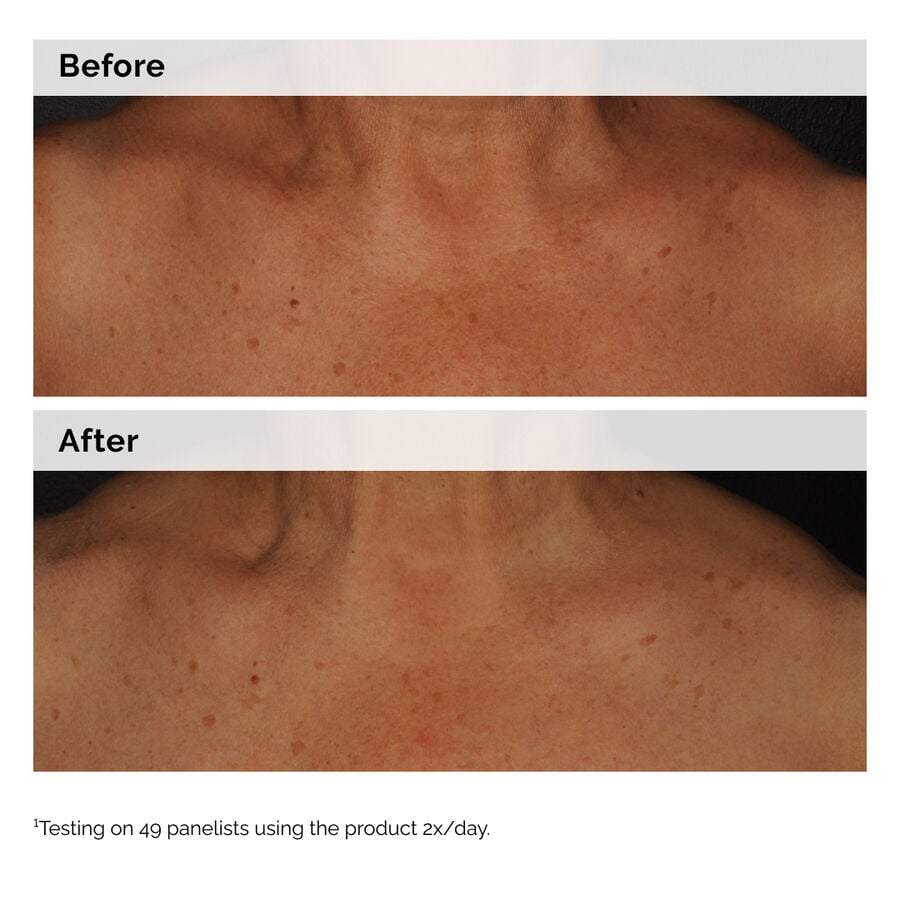 Niacinamide 5% Lightweight Face + Body Emulsion