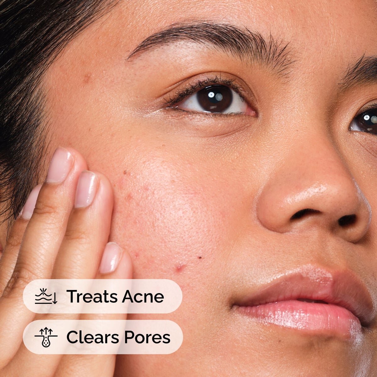 Salicylic Acid 2% Serum for Acne-Prone Skin
