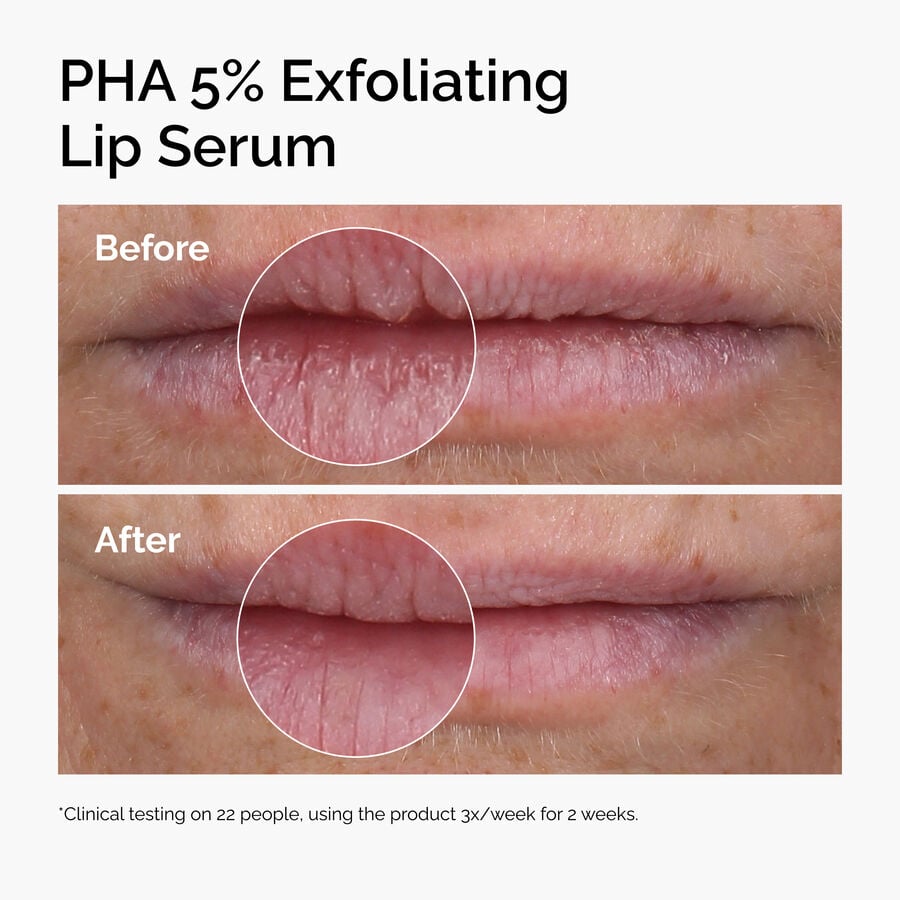 PHA 5% Smoothing and Hydrating Lip Serum
