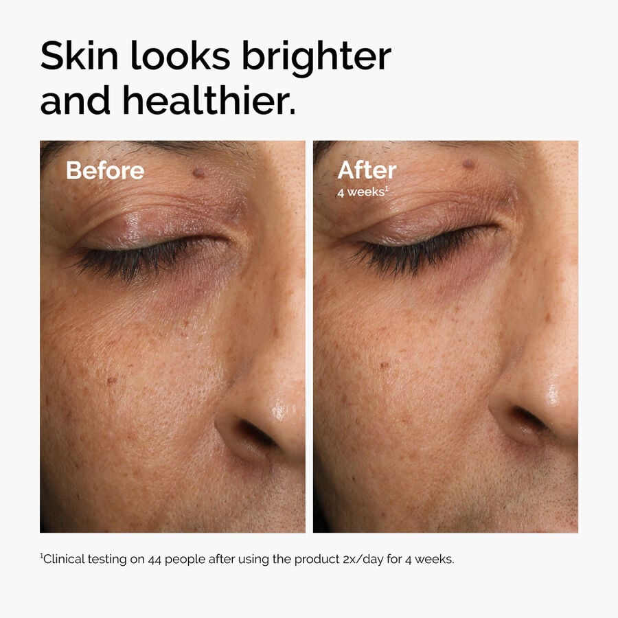Daily Multi-Antioxidant Radiance Serum