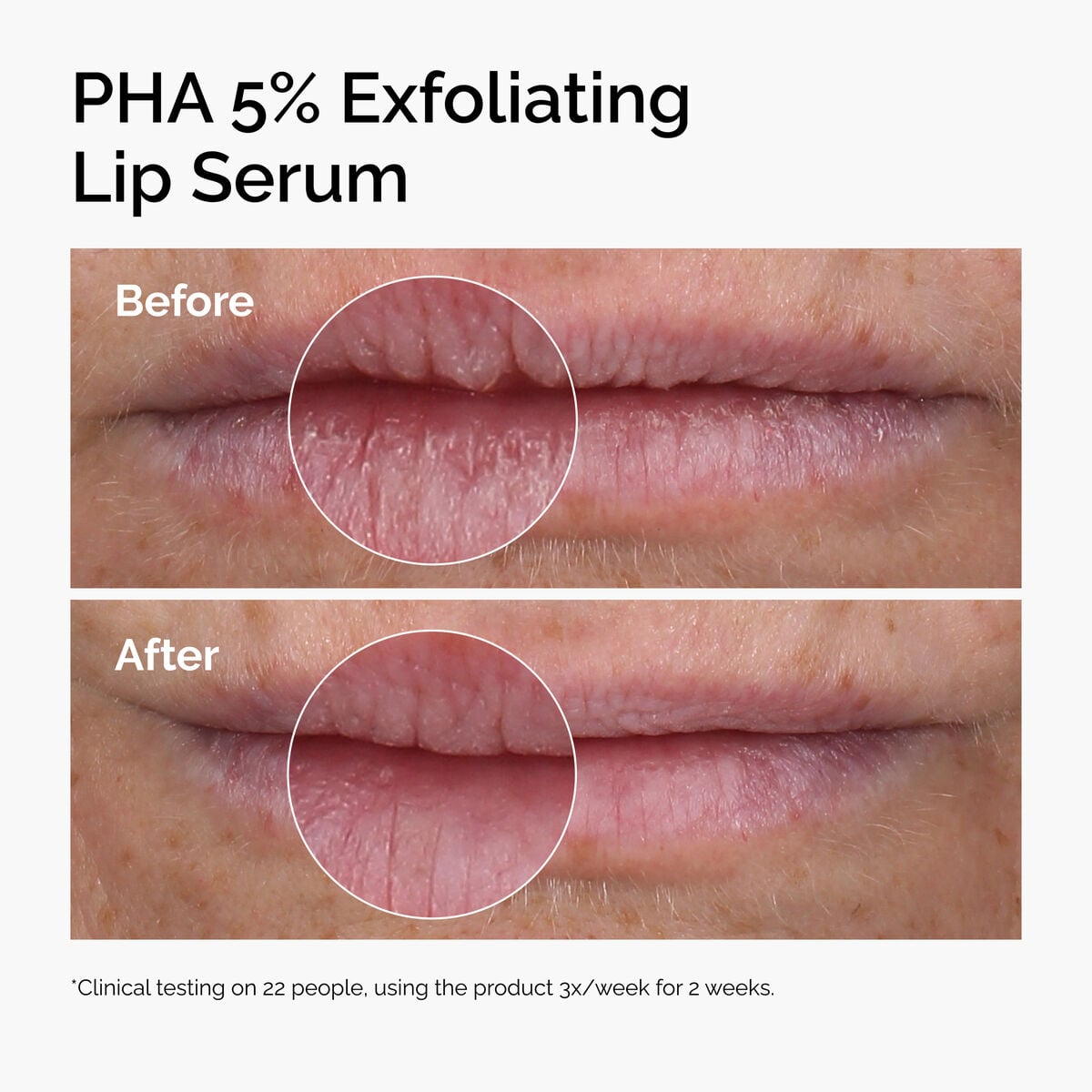 PHA 5% Smoothing and Hydrating Lip Serum
