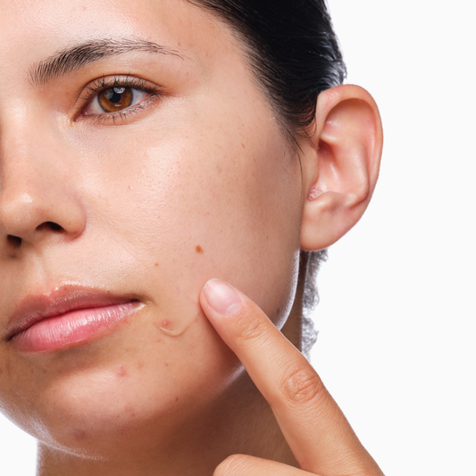 3-Step Salicylic Acid 2% Acne Skincare Set
