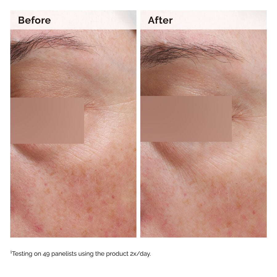 Niacinamide 5% Lightweight Face + Body Emulsion